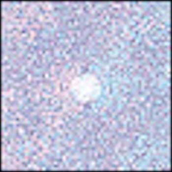 FILTRO COKIN A088 DIFUSOR COLOR FRIO